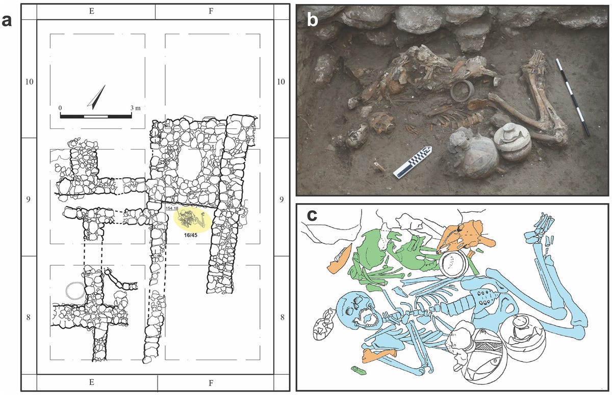 Evidence of brain surgery on a 3,000-year-old skull has been found by scientists